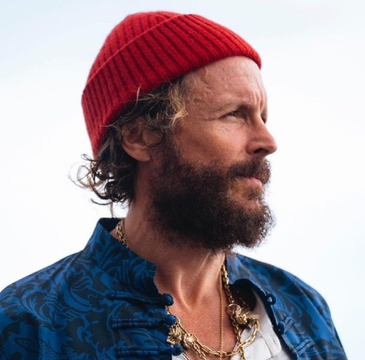 Jovanotti dopo l’incidente  slitta ritorno in Italia femore non allineato  