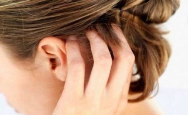 Vi è Mai Capitato Di Provare Dolore Ai Capelli Non è Mal Di