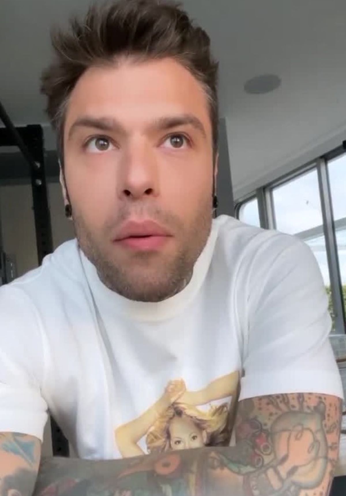 Fedez Incidente Montagna Ferite Volto