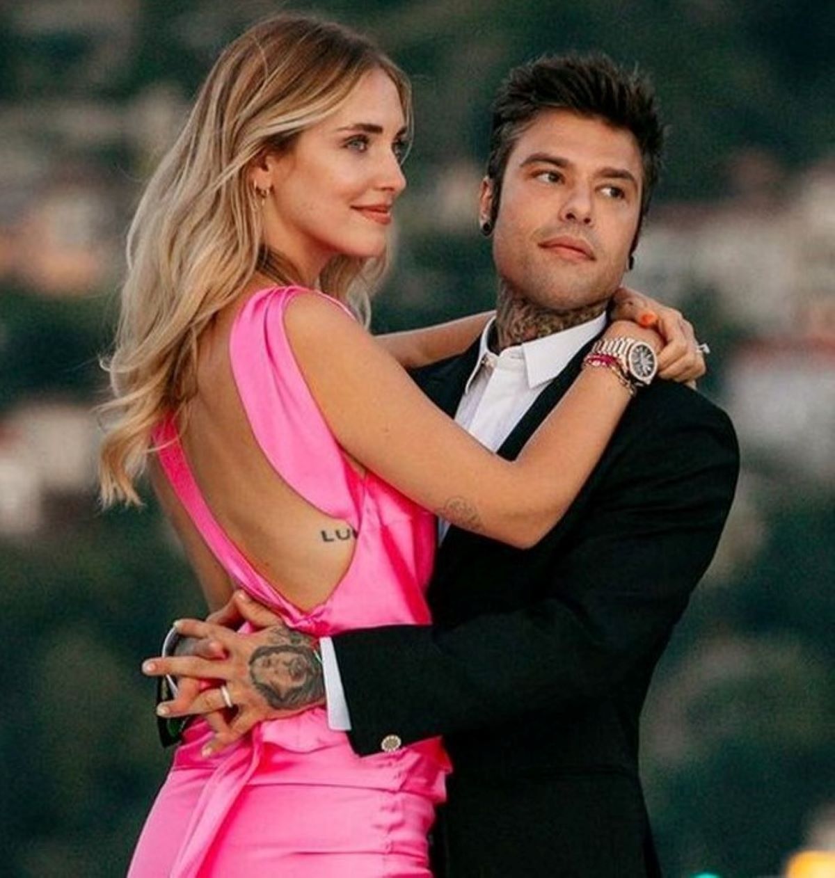 Fedez Incidente Montagna Svizzera Ferito Volto