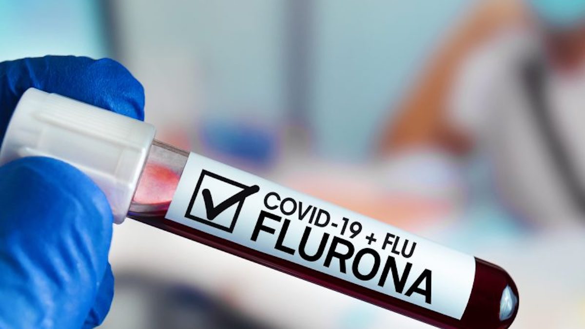 Flurona sintomi infezione Covid influenza