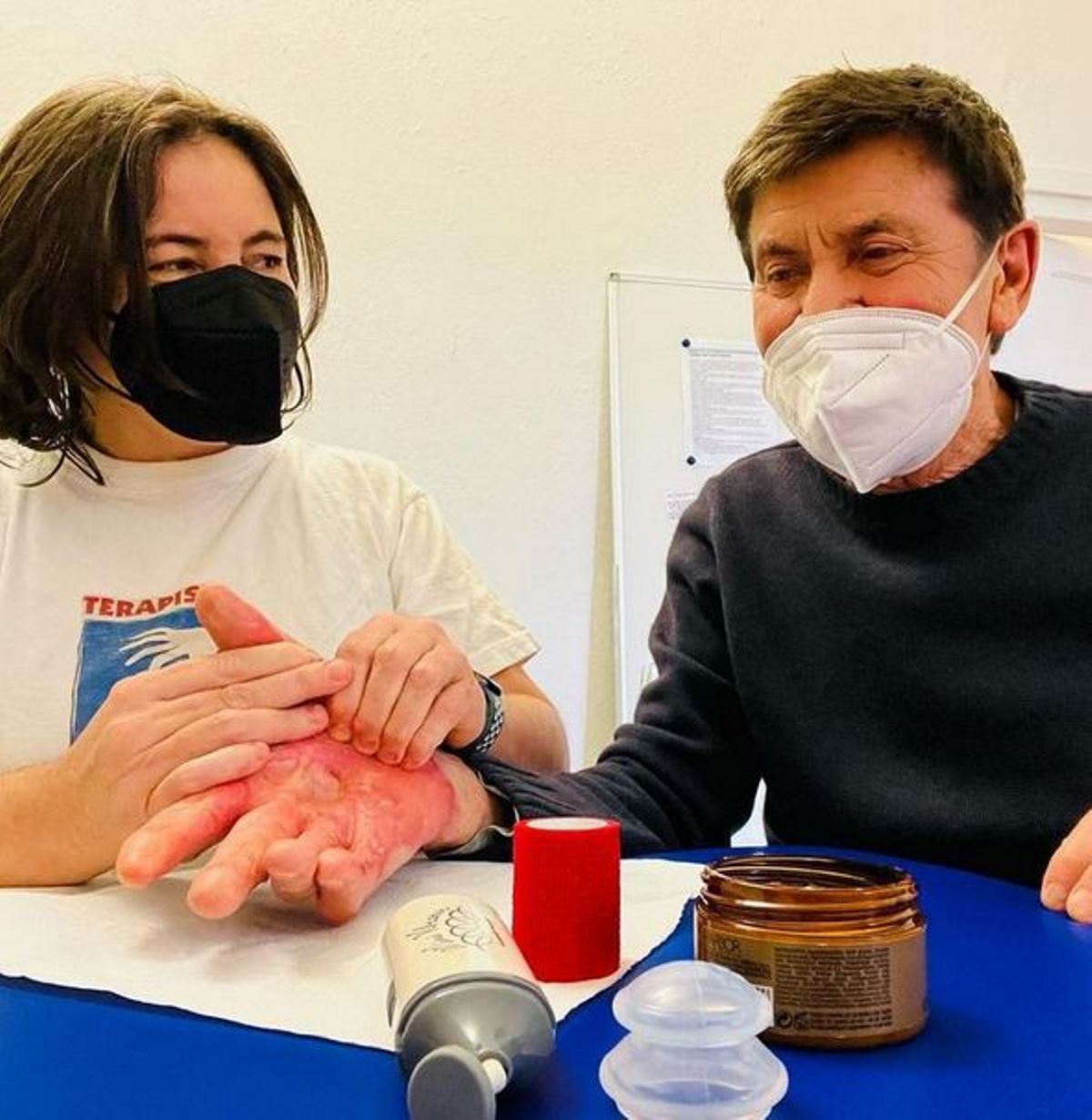 gianni morandi foto mano ustionata