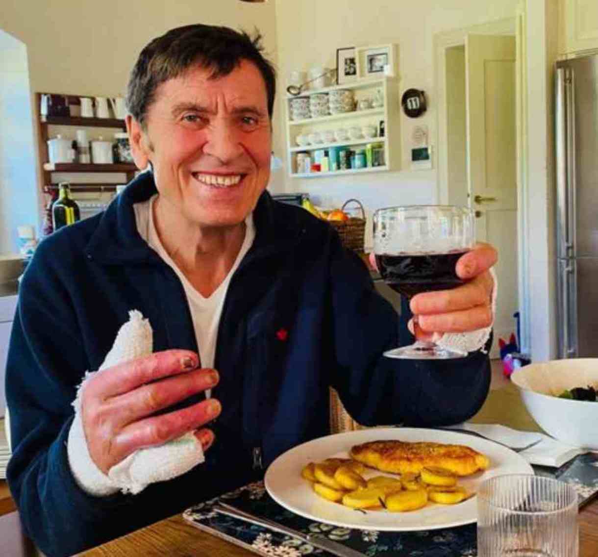 gianni morandi mano ustionata