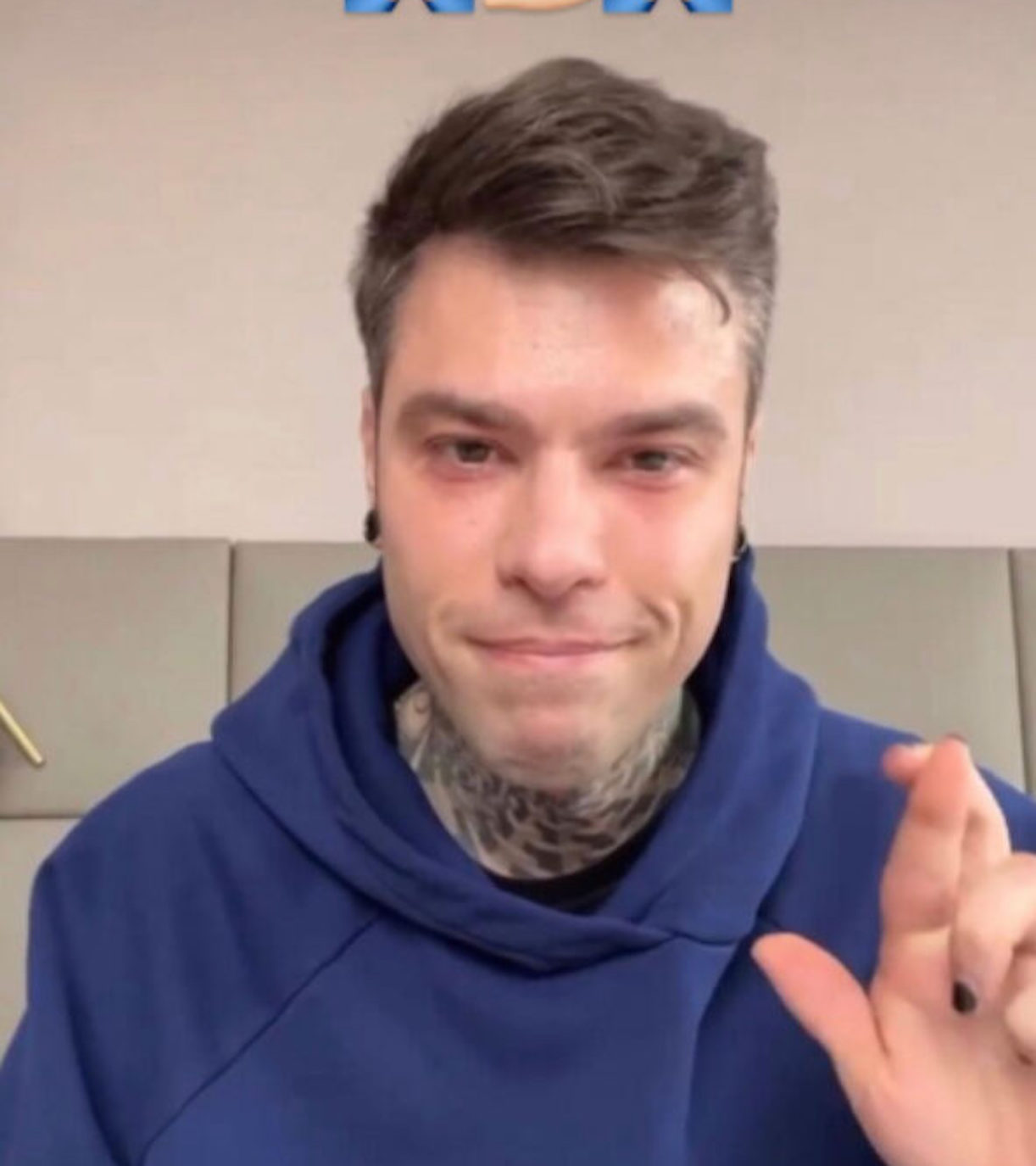 fedez dimesso ospedale giovedì 31 marzo