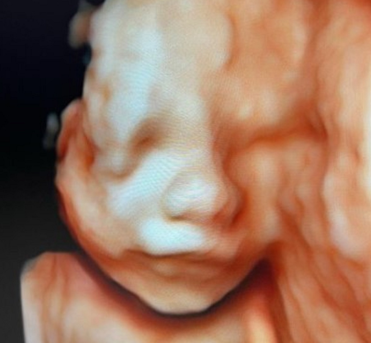 Francesca Ferragni foto ecografia viso bebè 