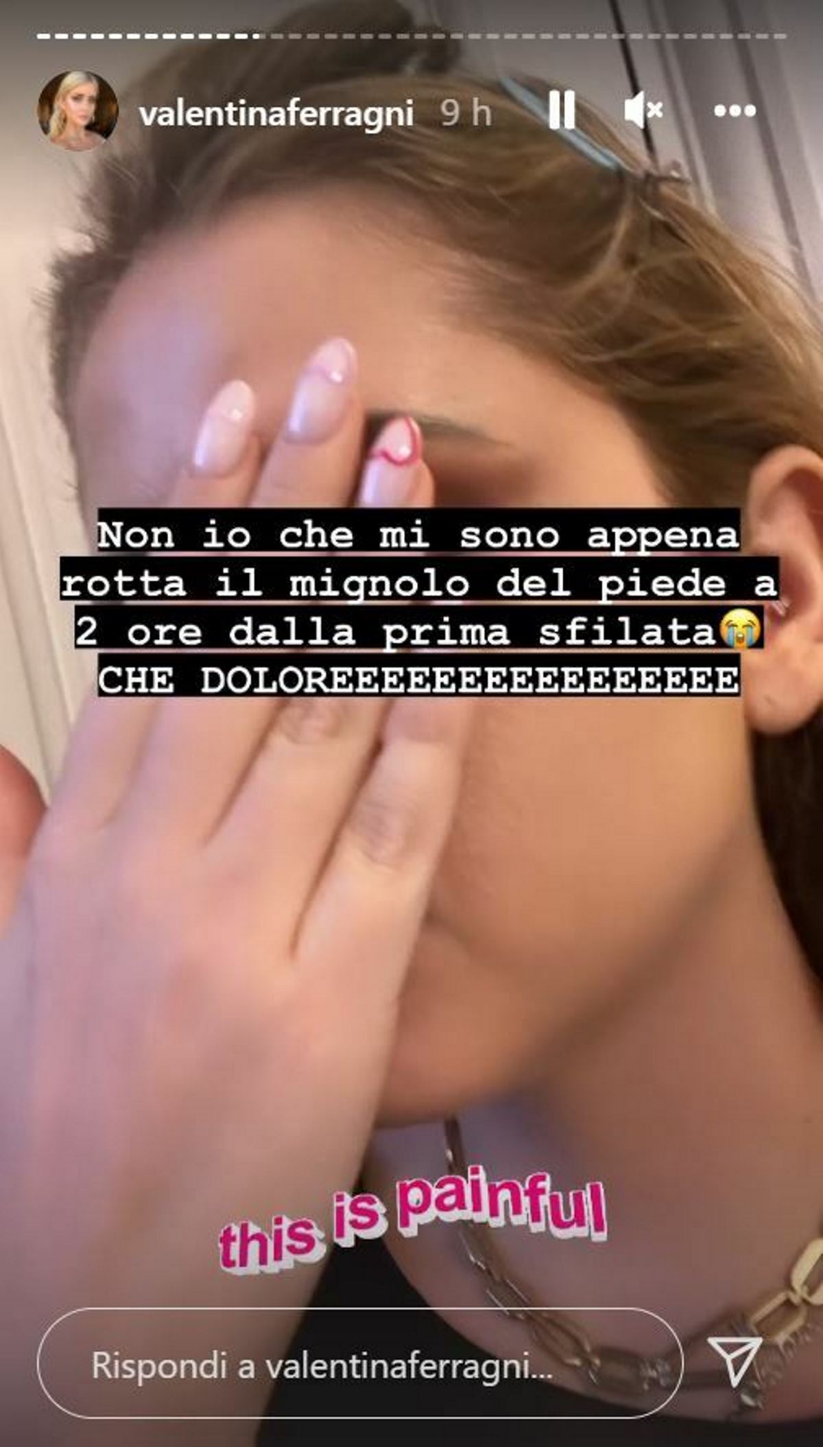 valentina ferragni frattura dito piede