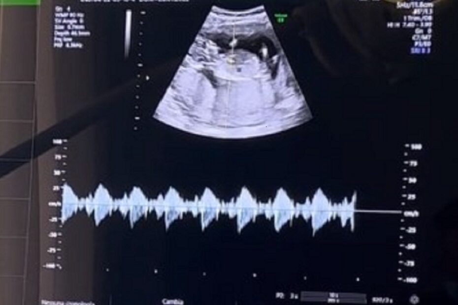Ciro Immobile papà per la quarta volta