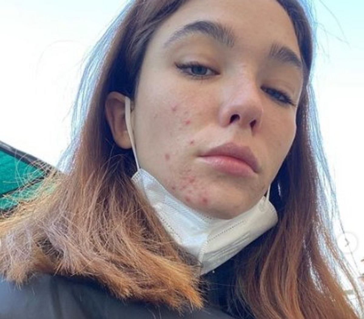 Matilda De Angelis e l'acne lo sfogo dell'attrice di 26 anni