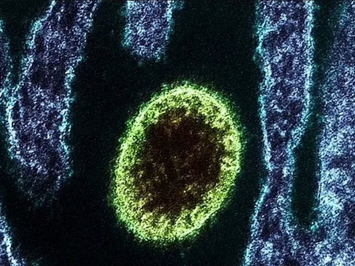 Langya scoperto un nuovo virus