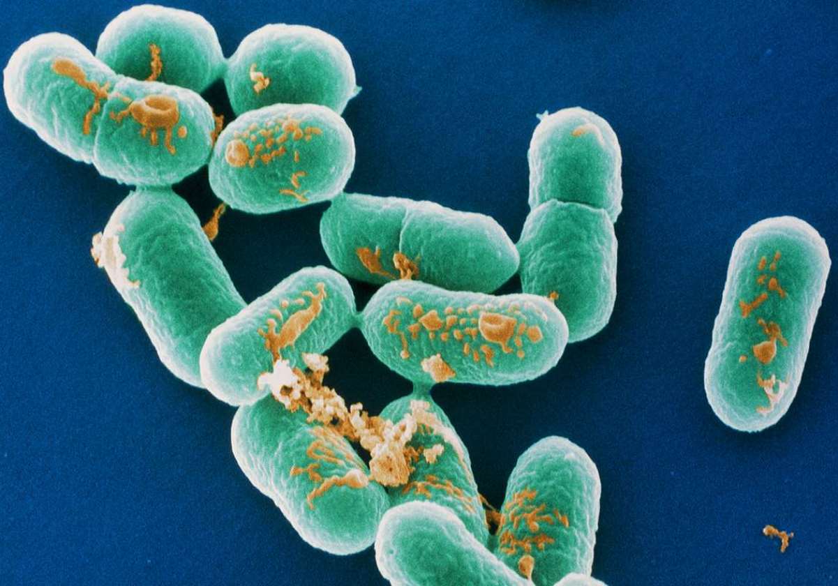 Listeria wurstel contaminati italia 3 morti sospette