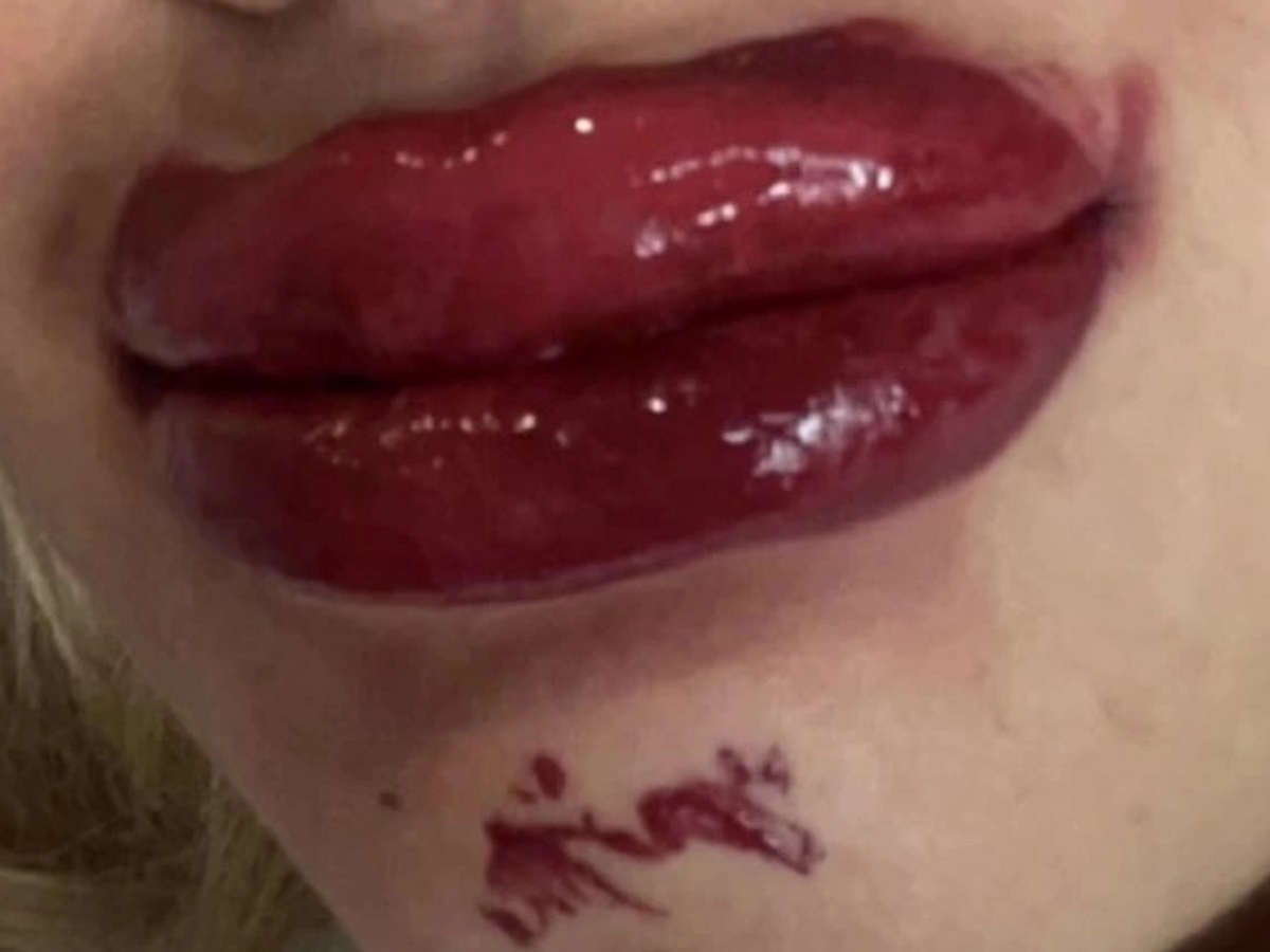 Melissa O’Callaghan si tatua le labbra, ma il risultato è disastroso