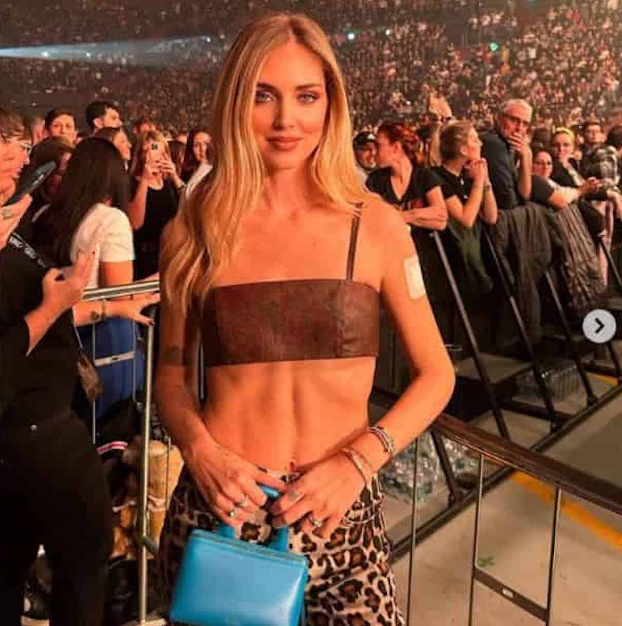 Perché Chiara Ferragni ha un cerotto sul braccio?