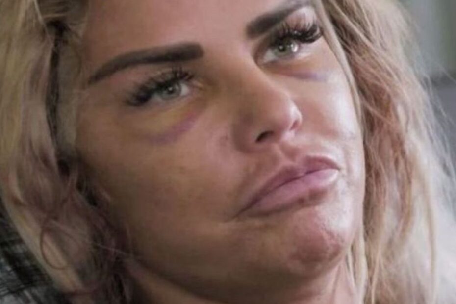 La showgirl Katie Price si è rifatta il seno per la sedicesima volta