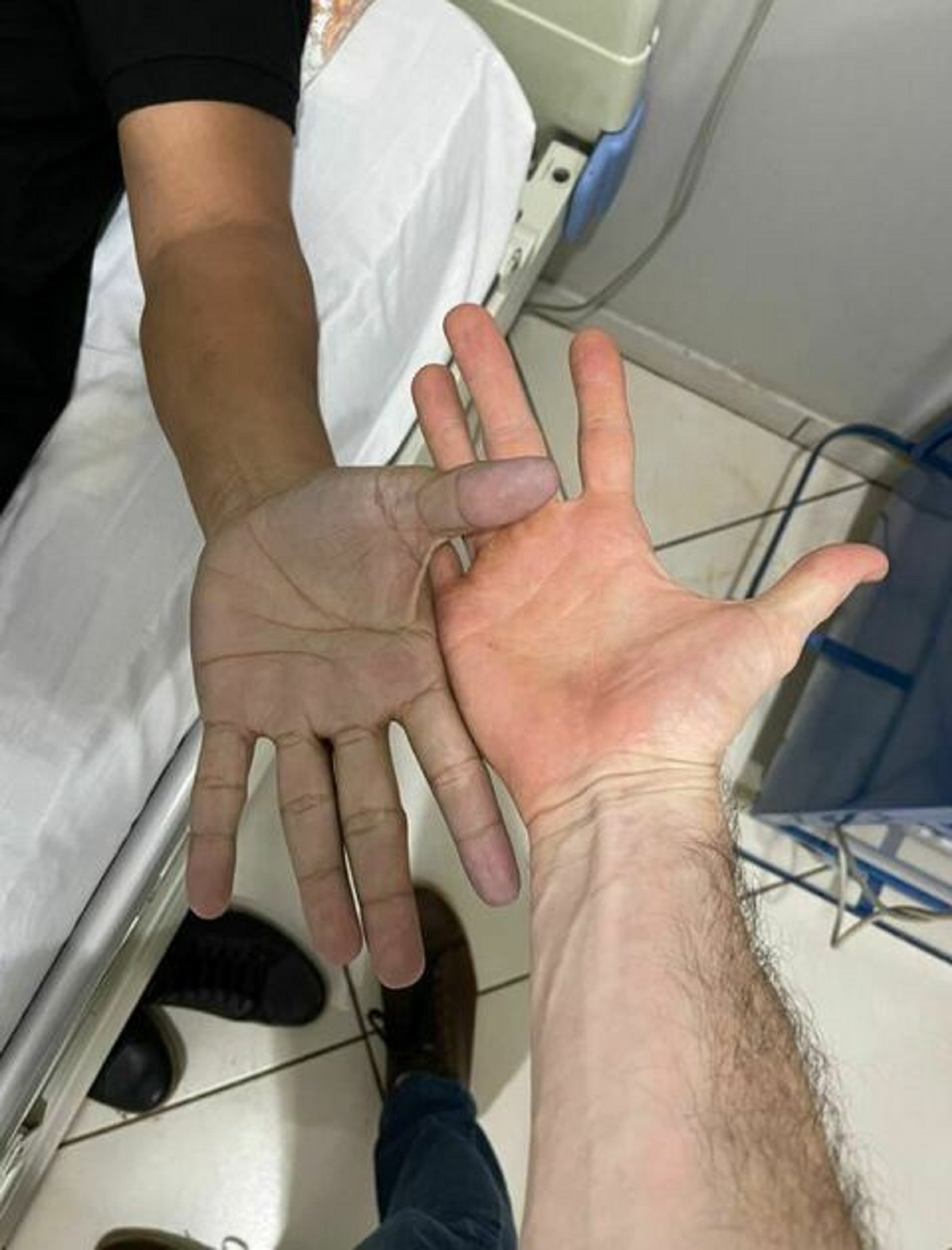 mani blu ospedale diagnosi 