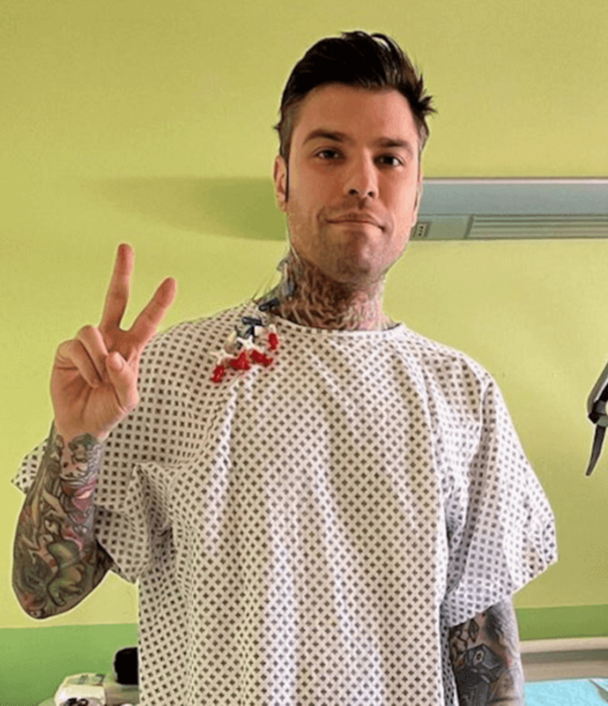 fedez ricoverato condizioni quando esce