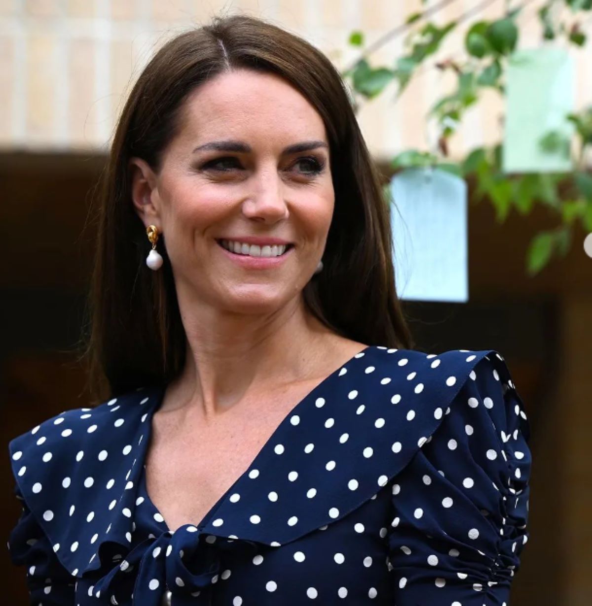 Kate Middleton Operata Addome
