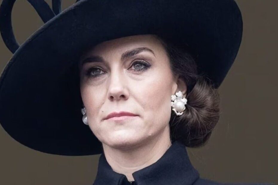 Kate Middleton Operata Addome