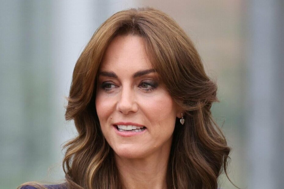 Kate Middleton Operazione Foto
