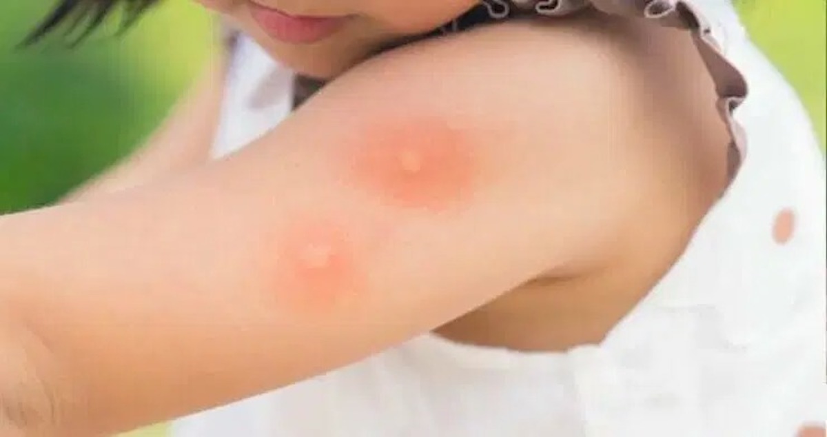 Repellente fai da te per le zanzare, la ricetta che funziona davvero