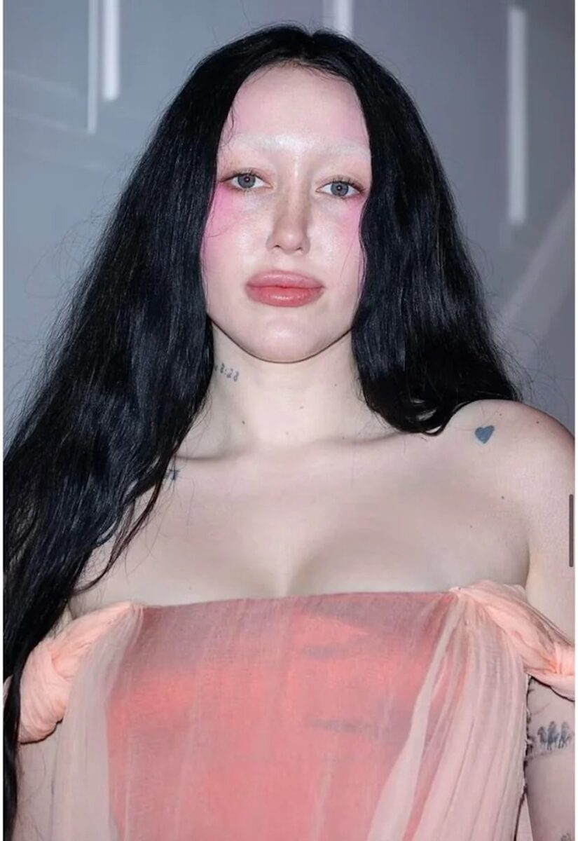 Noah Cyrus e la chirurgia estetica: le foto della trasformazione della cantante 