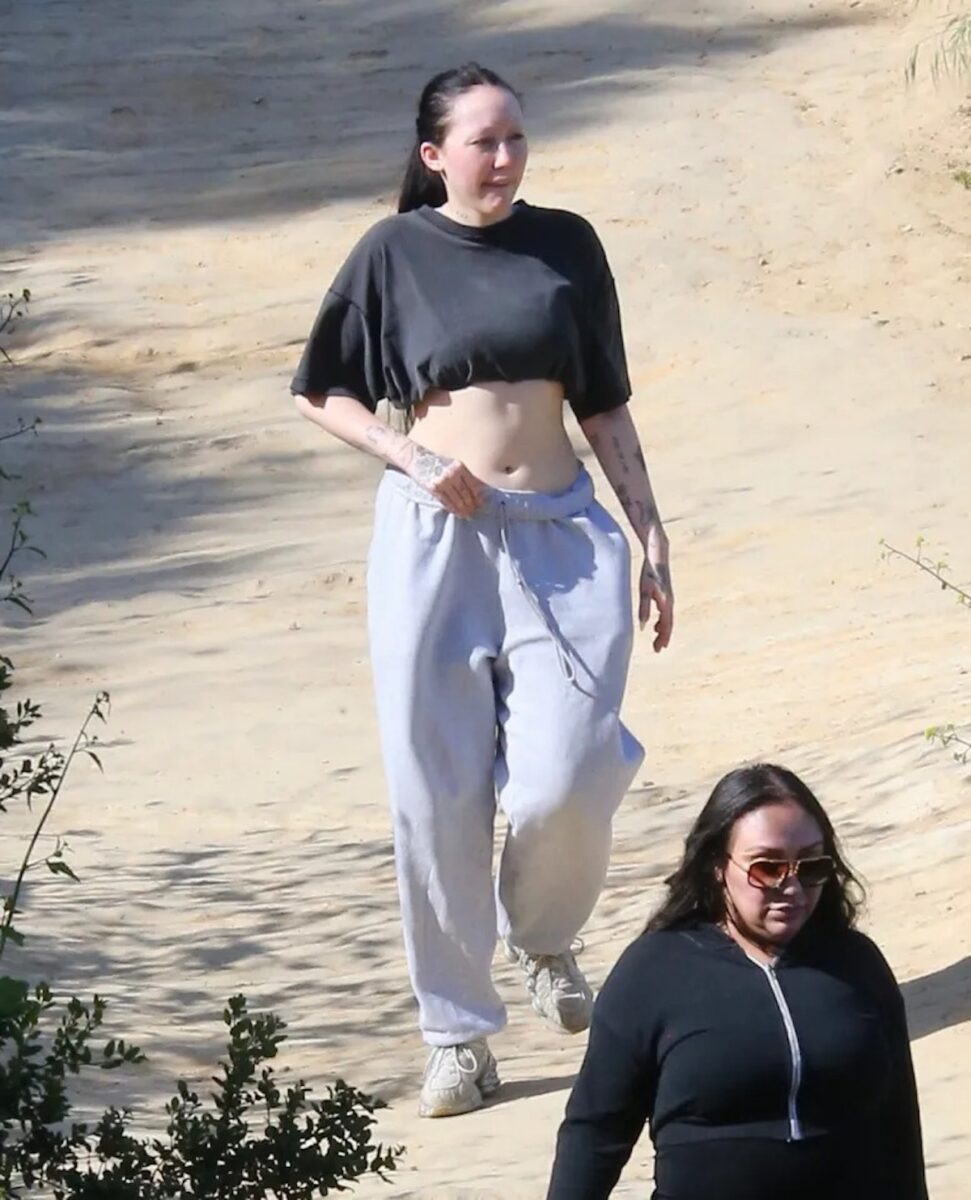 Noah Cyrus e la chirurgia estetica: le foto della trasformazione della cantante 