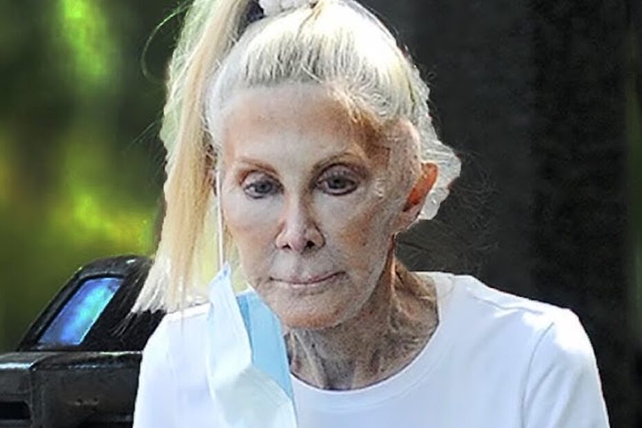 Joan Van Ark, l'attrice di Dallas devastata dalla chirurgia