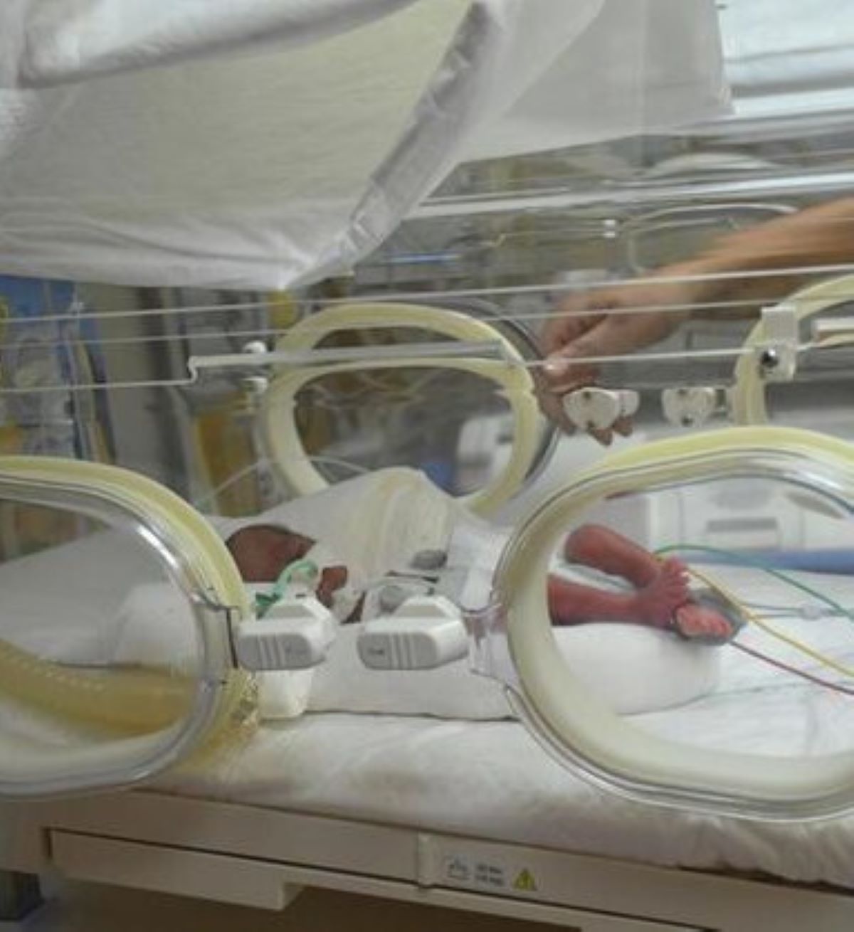 Morti Neonati Ospedale