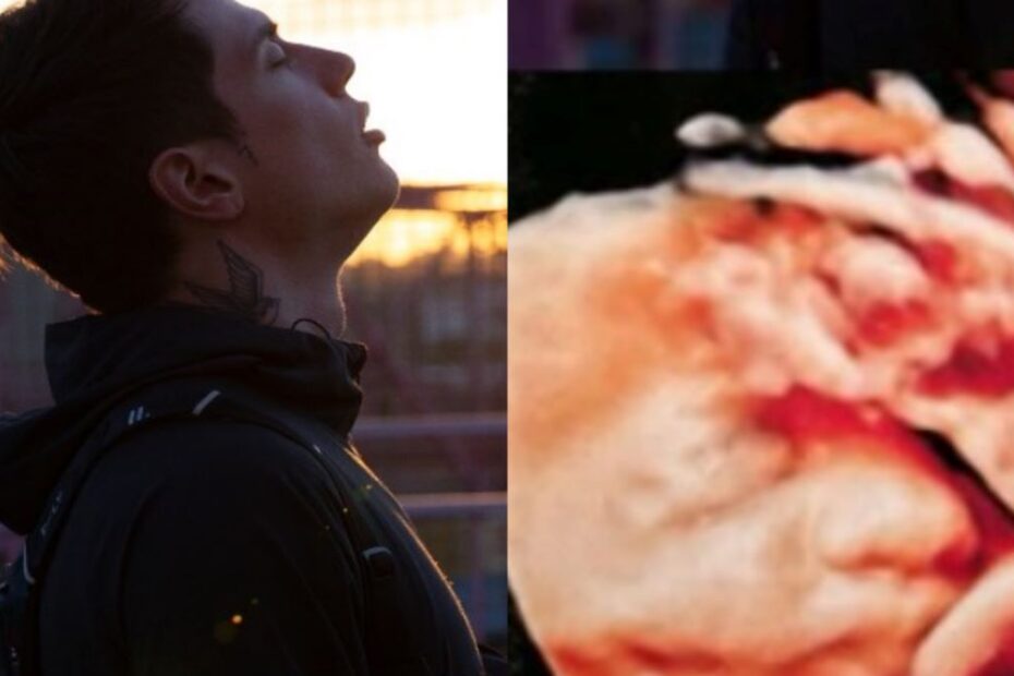 Cantante Perso Due Figli