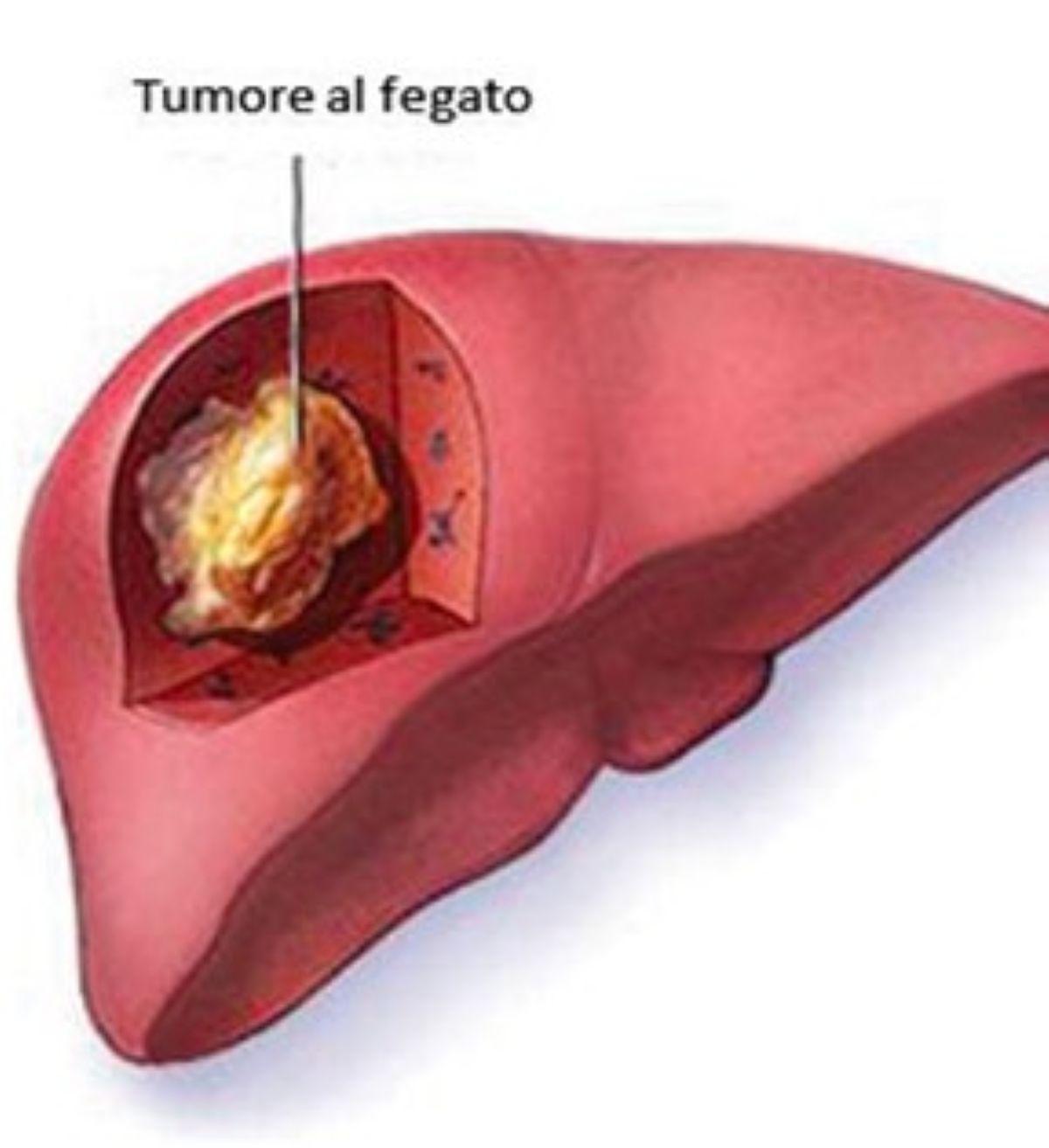 macchie scure occhio diagnosi terribile