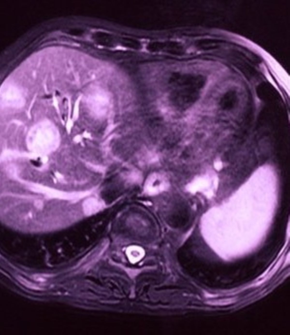 macchie scure occhio diagnosi terribile