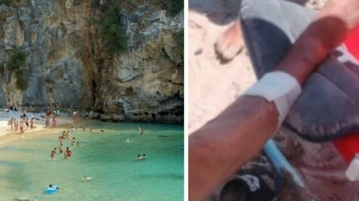 bagnanti morsi dai pesci il parere dell8217esperto sulla specie e le conseguenze per l8217uomo da Caffeinamagazine.it bagnanti morsi dai pesci il parere dell8217esperto sulla specie e le conseguenze per l8217uomo