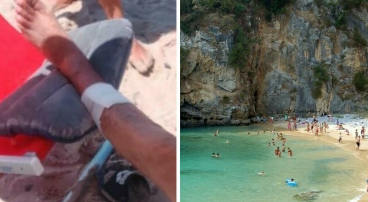 lesioni e tanto sangue turisti morsi da pesci panico tra i bagnanti la scoperta dopo gli attacchi160 da Caffeinamagazine.it lesioni e tanto sangue turisti morsi da pesci panico tra i bagnanti la scoperta dopo gli attacchi160